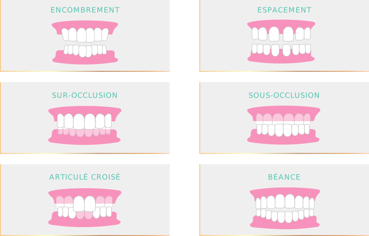 Résultats et cas traitables Smilers®