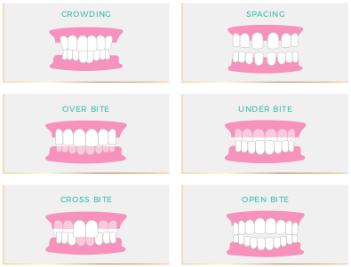 Visuel éligibilité au traitement smilers